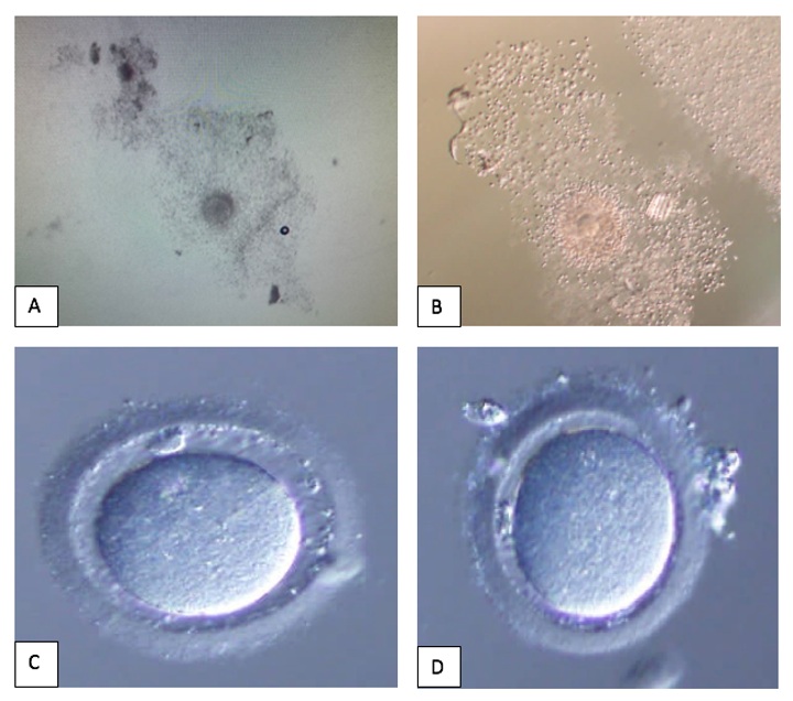 This showed oocytes denudation process. (A) Cumulus Oocytes Complex prepared for mechanical denudation without enzyme; (B) Cumulus Oocytes Complex enzymolysed in hyaluronidase; (C) “Naked” oocytes following enzymolysed in hyaluronidase – clean edge; (D) “Naked” oocytes following mechanical denudation – minimal cumulus cell at the edge