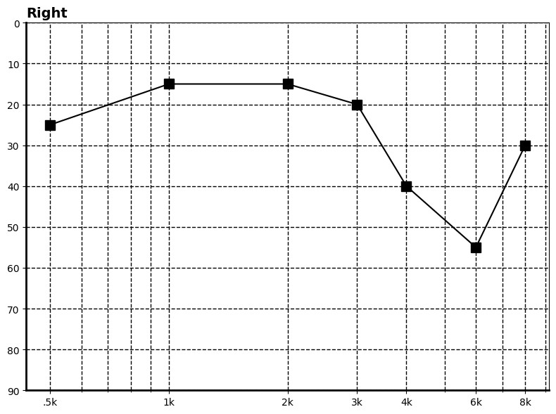 The repeated PTA result with masking (right ear)