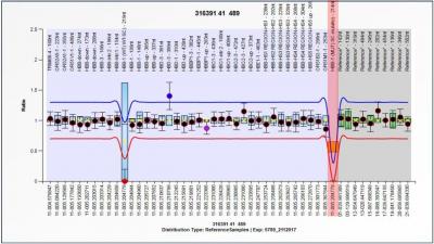 Figure 1: MLPA demonstrating presence of HbS mutation (HBB:c.20A>T, rs334)  (highlighted red).